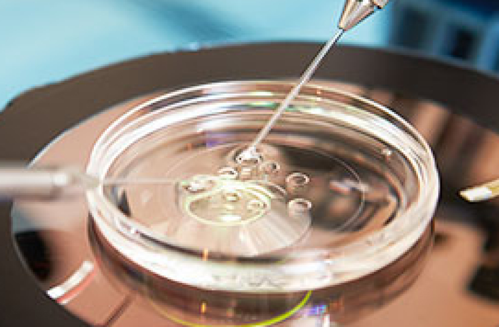 Image assisted reproductive technology mobile
