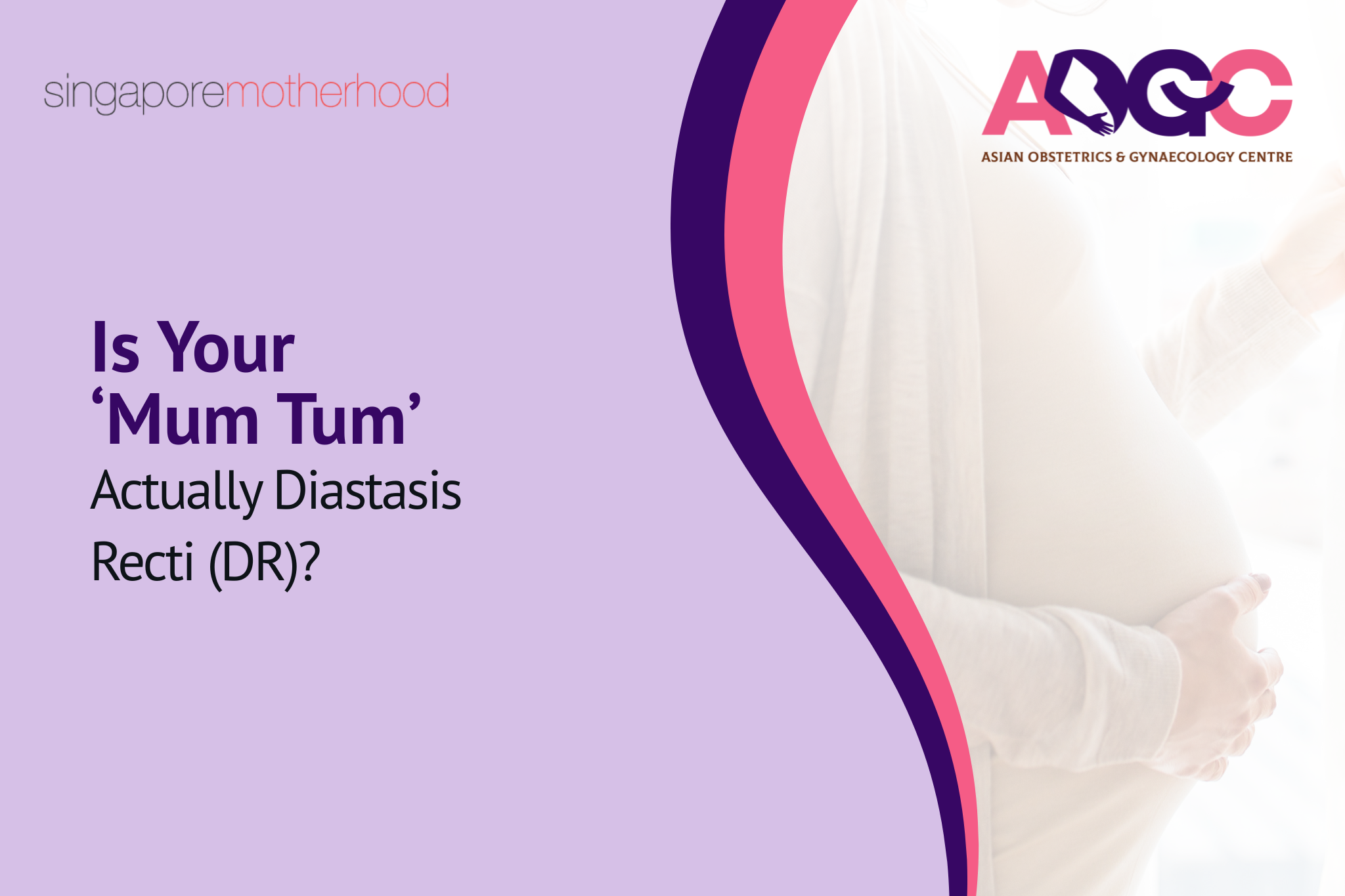 Is Your ‘Mum Tum’ Actually Diastasis Recti (DR)?