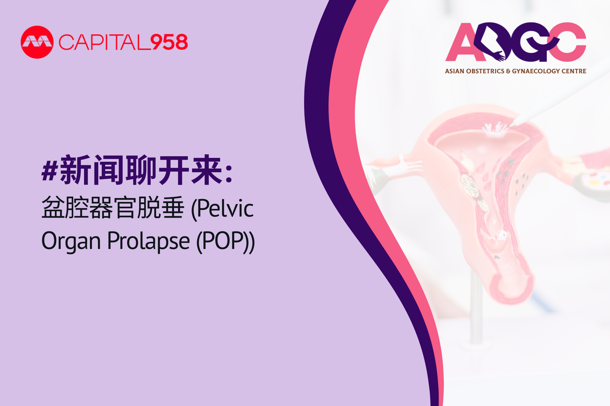 新闻聊开来: 盆腔器官脱垂 (Pelvic Organ Prolapse (POP))