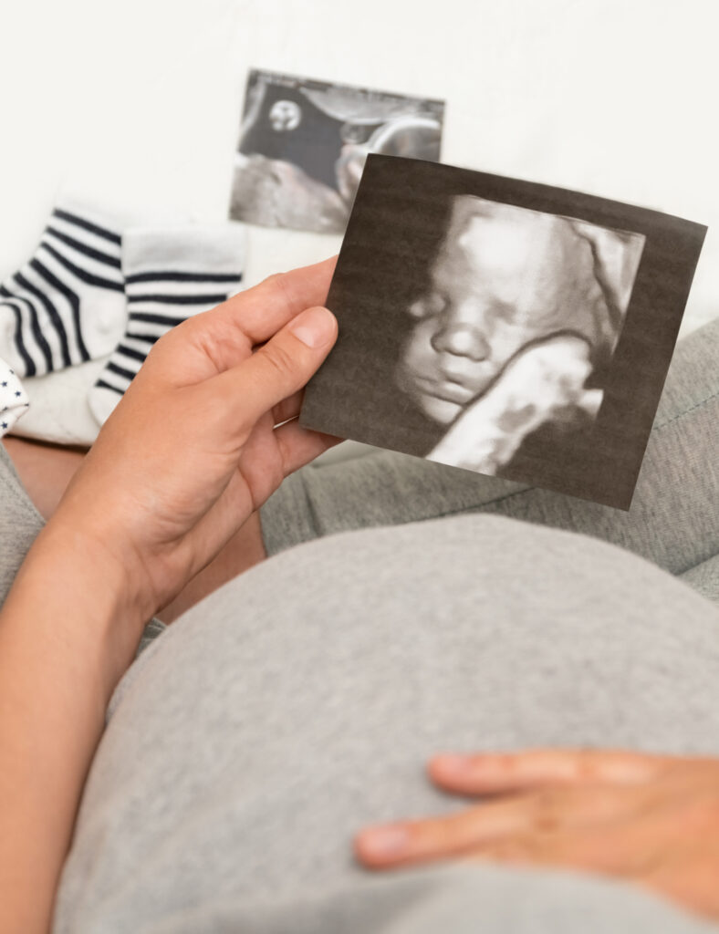 Service (3D Fetal Ultrasound)